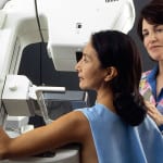 breast cancer survivor free mammogram