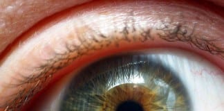 Zion Eye Institute implants first ocular telescope in southern Utah Zion Eye Institute telescope implant macular degeneration