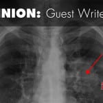 Necitumumab and how doctors devalue patients’ lives Necitumumab
