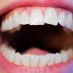 Five serious health issues linked to gum disease Your dentist keeps warning you about bleeding or inflamed gums for a reason. They can be a gateway to five serious health issues linked to gum disease.
