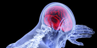 Memory Matters offers frontal-temporal dementia support group Memory Matters offers frontal-temporal dementia support group