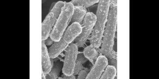Lactobacillus fermentum VRI-003 clinically demonstrated to reduce gas and bloating Lactobacillus fermentum VRI-003 clinically demonstrated to reduce gas and bloating