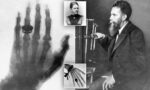Today In History: A Physics Breakthrough That Would Change Medicine Forever Wilhelm Conrad Roentgen